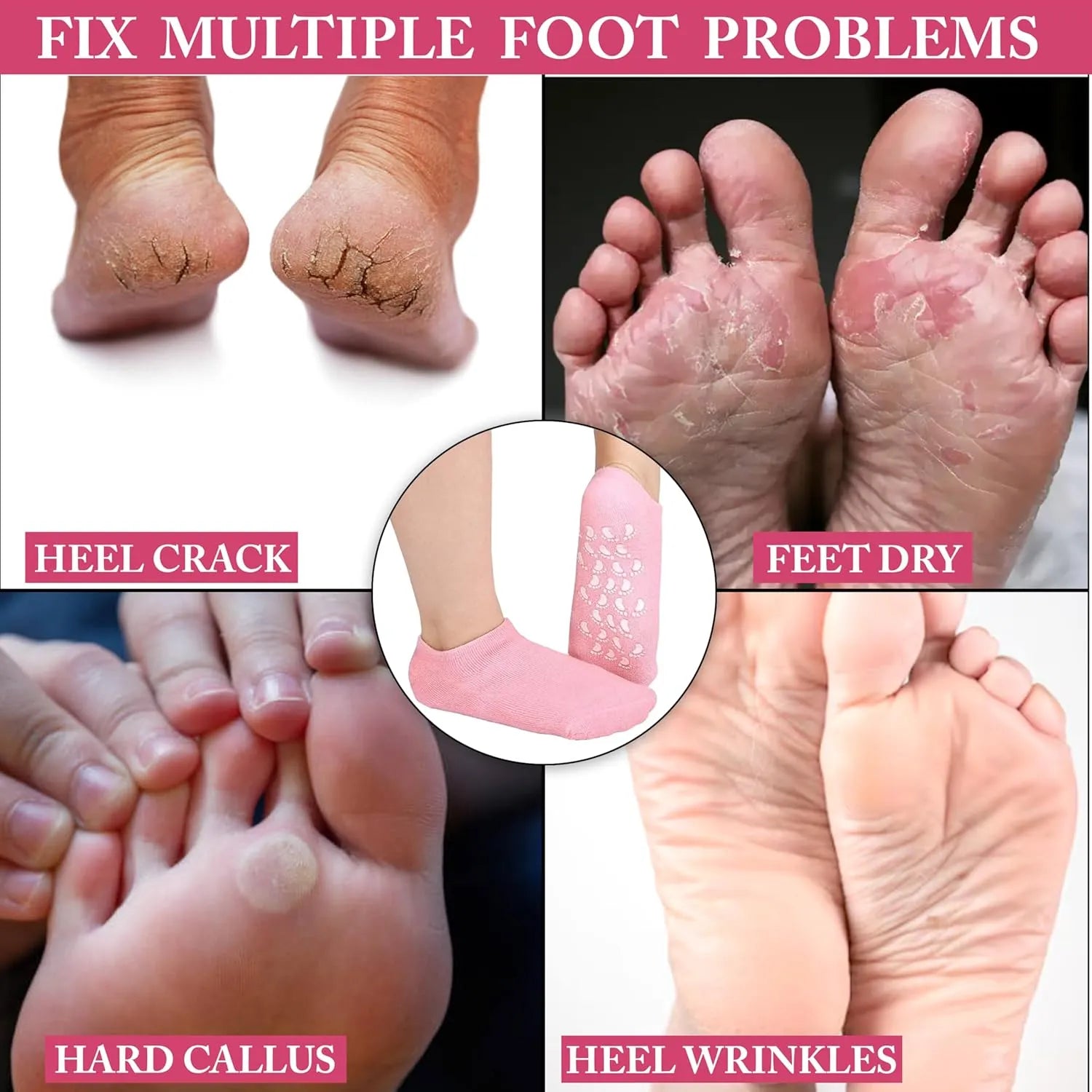 CRACK HEALS SILICONE MOISTURIZING GEL SOCKS (IMPORTED)